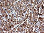 HSD17B4 Antibody in Immunohistochemistry (Paraffin) (IHC (P))