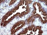 HSD17B4 Antibody in Immunohistochemistry (Paraffin) (IHC (P))