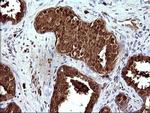 HSD17B4 Antibody in Immunohistochemistry (Paraffin) (IHC (P))