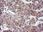 CHAC1 Antibody in Immunohistochemistry (Paraffin) (IHC (P))