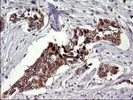 CHAC1 Antibody in Immunohistochemistry (Paraffin) (IHC (P))