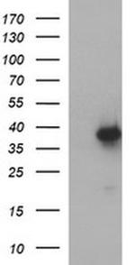 MCAT Antibody in Western Blot (WB)