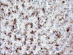 AMOT Antibody in Immunohistochemistry (Paraffin) (IHC (P))