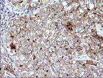 SR-BI Antibody in Immunohistochemistry (Paraffin) (IHC (P))