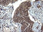 SCRN1 Antibody in Immunohistochemistry (Paraffin) (IHC (P))