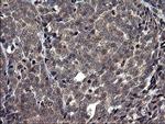 TXNDC5 Antibody in Immunohistochemistry (Paraffin) (IHC (P))