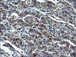 GCLC Antibody in Immunohistochemistry (Paraffin) (IHC (P))