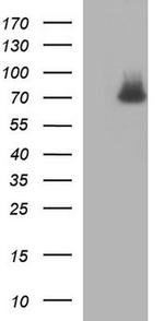 GCLC Antibody in Western Blot (WB)