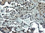 RPRD1B Antibody in Immunohistochemistry (Paraffin) (IHC (P))