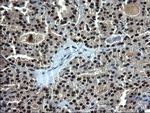 RPRD1B Antibody in Immunohistochemistry (Paraffin) (IHC (P))