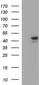 RPRD1B Antibody in Western Blot (WB)