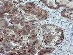 PYCARD Antibody in Immunohistochemistry (Paraffin) (IHC (P))