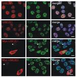 UBE2E3 Antibody in Immunocytochemistry (ICC/IF)