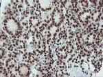 UBE2E3 Antibody in Immunohistochemistry (Paraffin) (IHC (P))