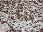 UBE2E3 Antibody in Immunohistochemistry (Paraffin) (IHC (P))