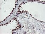 UBE2E3 Antibody in Immunohistochemistry (Paraffin) (IHC (P))