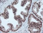 UBE2E3 Antibody in Immunohistochemistry (Paraffin) (IHC (P))