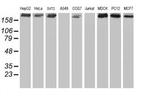 USP9X Antibody in Western Blot (WB)