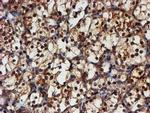 PSMA6 Antibody in Immunohistochemistry (Paraffin) (IHC (P))