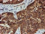 PSMA6 Antibody in Immunohistochemistry (Paraffin) (IHC (P))