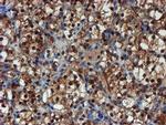 PSMA6 Antibody in Immunohistochemistry (Paraffin) (IHC (P))