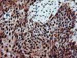 PSMA6 Antibody in Immunohistochemistry (Paraffin) (IHC (P))