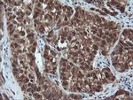 PSMA6 Antibody in Immunohistochemistry (Paraffin) (IHC (P))