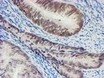 SENP2 Antibody in Immunohistochemistry (Paraffin) (IHC (P))