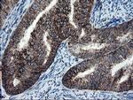 SnoN Antibody in Immunohistochemistry (Paraffin) (IHC (P))