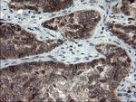 SnoN Antibody in Immunohistochemistry (Paraffin) (IHC (P))