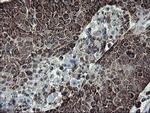 SnoN Antibody in Immunohistochemistry (Paraffin) (IHC (P))