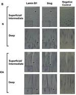 SLUG Antibody in Immunohistochemistry (Paraffin) (IHC (P))