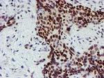 SLUG Antibody in Immunohistochemistry (Paraffin) (IHC (P))