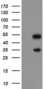 SLUG Antibody in Western Blot (WB)