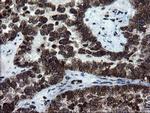 SnoN Antibody in Immunohistochemistry (Paraffin) (IHC (P))