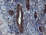 SnoN Antibody in Immunohistochemistry (Paraffin) (IHC (P))