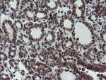 SnoN Antibody in Immunohistochemistry (Paraffin) (IHC (P))