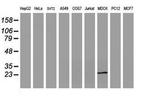 RBPMS Antibody in Western Blot (WB)