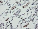 TPRKB Antibody in Immunohistochemistry (Paraffin) (IHC (P))