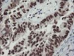 TPRKB Antibody in Immunohistochemistry (Paraffin) (IHC (P))