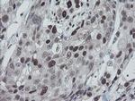 TPRKB Antibody in Immunohistochemistry (Paraffin) (IHC (P))