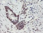 TPRKB Antibody in Immunohistochemistry (Paraffin) (IHC (P))