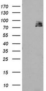 TPRKB Antibody in Western Blot (WB)