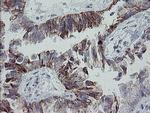 MRPS27 Antibody in Immunohistochemistry (Paraffin) (IHC (P))