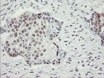 RFC2 Antibody in Immunohistochemistry (Paraffin) (IHC (P))