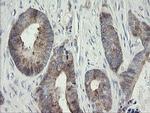 METAP2 Antibody in Immunohistochemistry (Paraffin) (IHC (P))