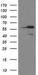 METAP2 Antibody in Western Blot (WB)