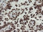 TLE1 Antibody in Immunohistochemistry (Paraffin) (IHC (P))