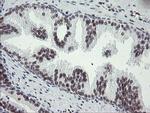 TLE1 Antibody in Immunohistochemistry (Paraffin) (IHC (P))