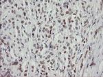 TLE1 Antibody in Immunohistochemistry (Paraffin) (IHC (P))